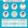 Typhoid Fever - Caused By A Bacterial Infection Town Pharmacy